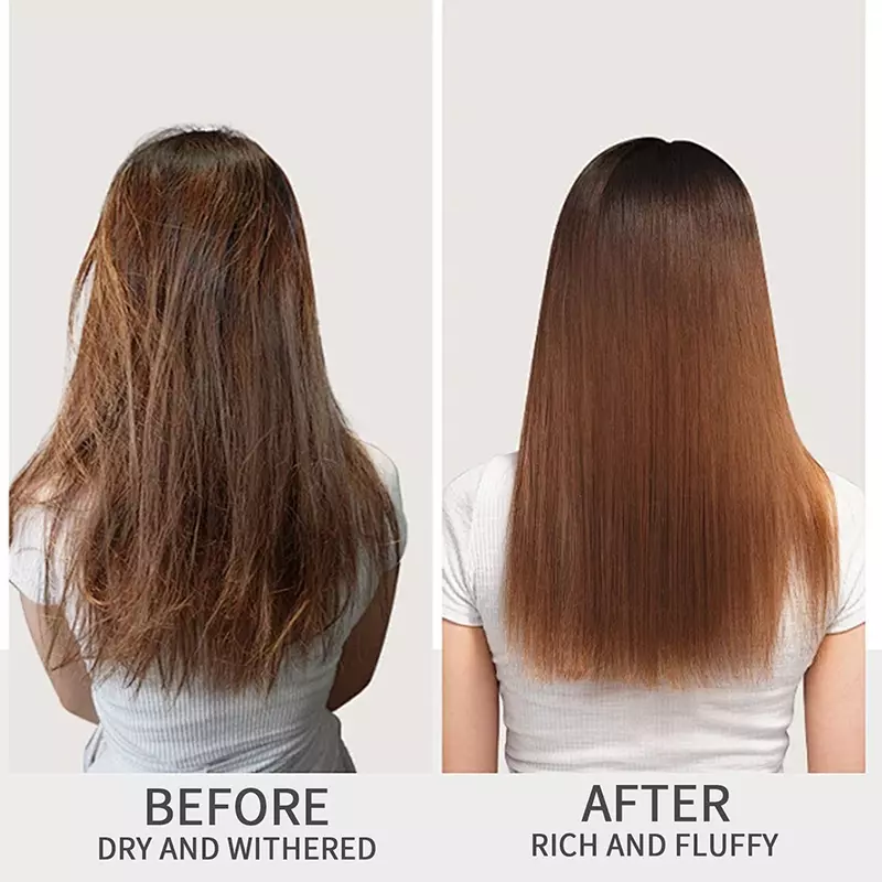 شامبو كيتوكونازول