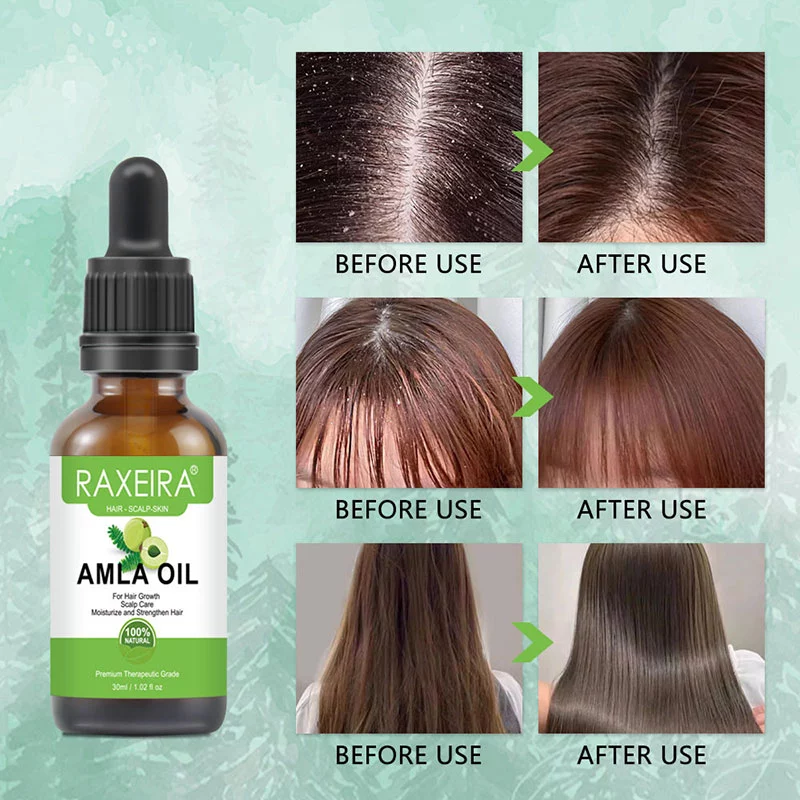 Amla hair oil