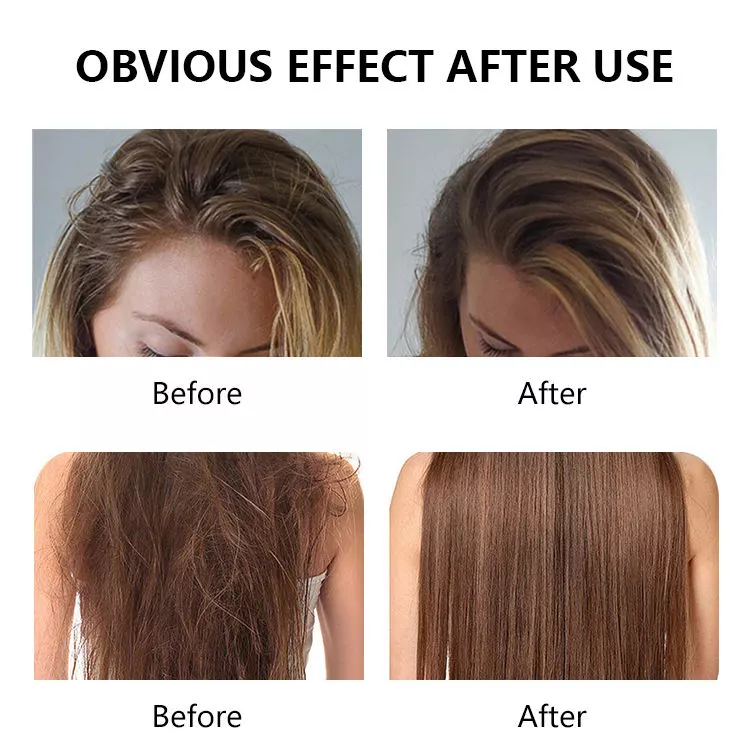 Lamellar water conditioner