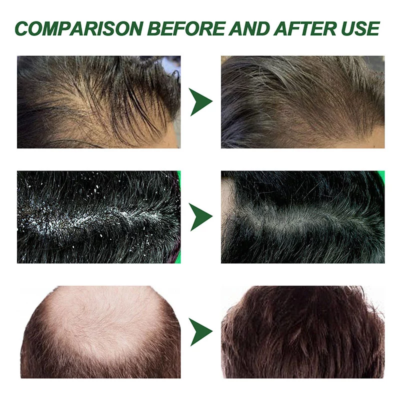 Volumizing root-lift shampoo
